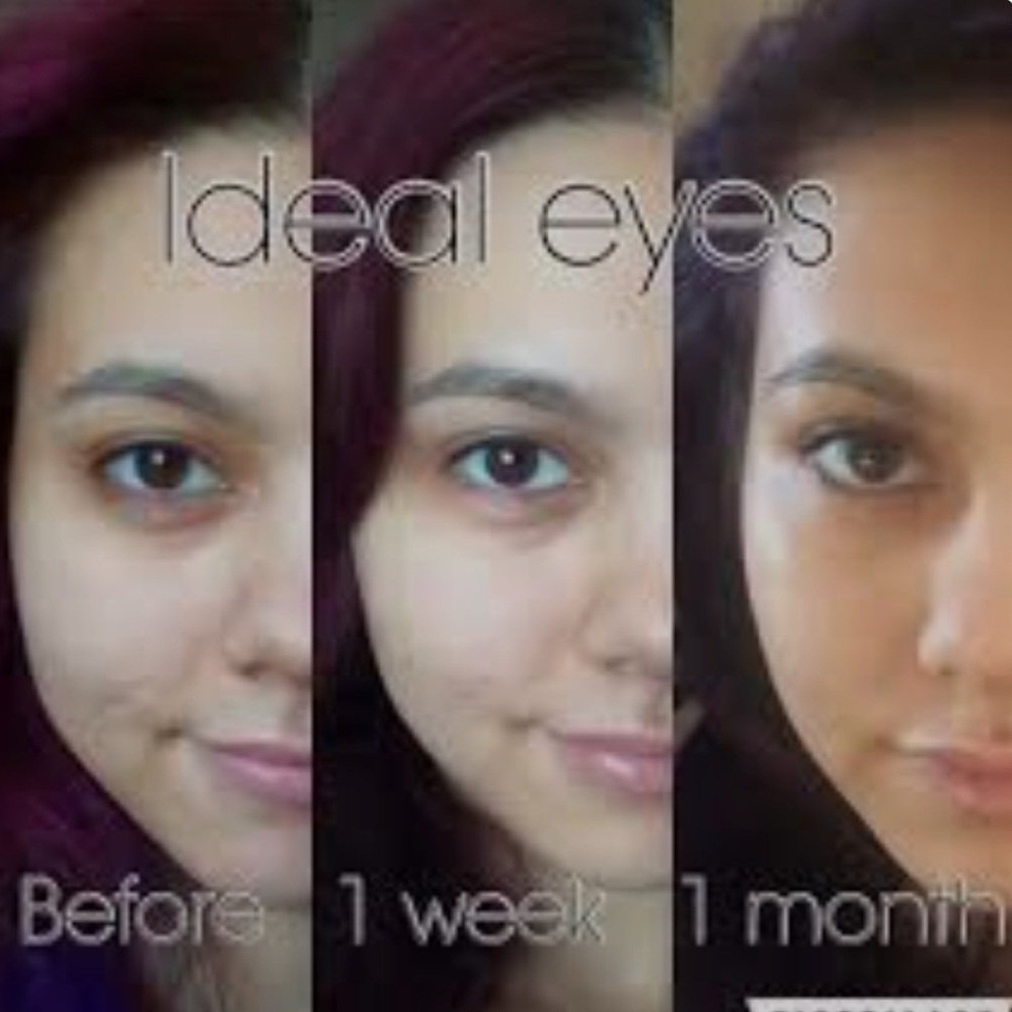 Before and after comparison of eyes, with text "Ideal eyes", showing skin tone changes over time