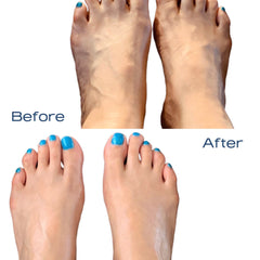 Hand applying rich white body butter to leg with visible varicose veins, showcasing soothing massage technique