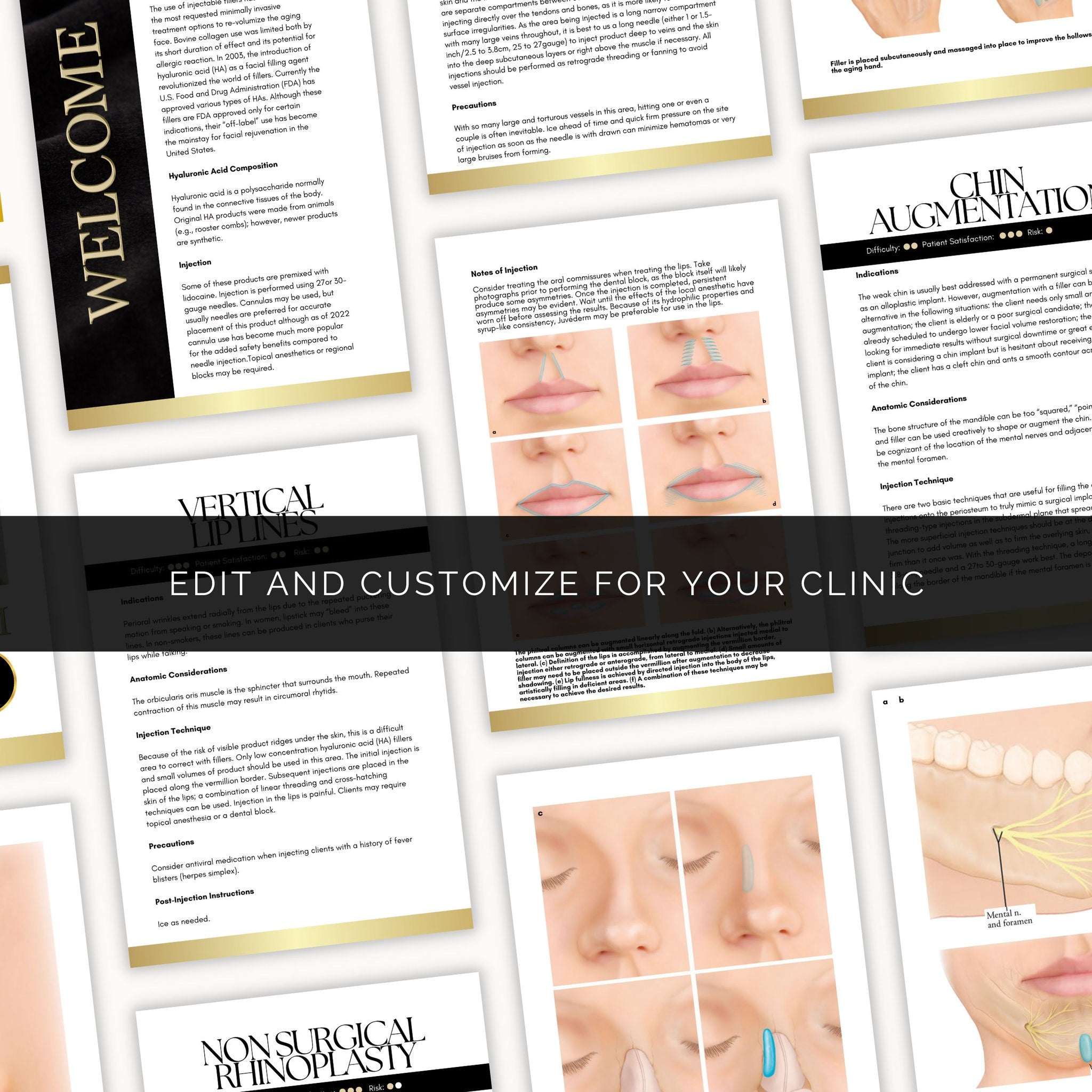 Professional injector training manual with glossy cover featuring Botox and dermal filler diagrams for nurses